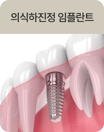 의식하진정 임플란트