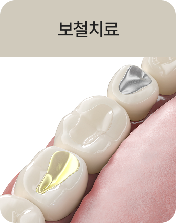 보철치료