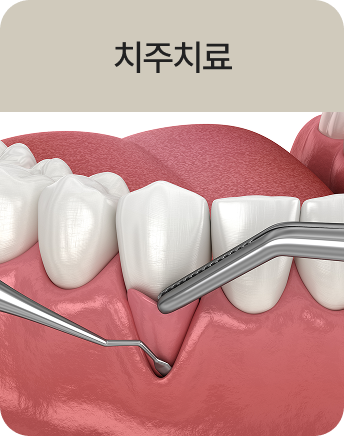치주치료